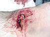 worst injury/near injury obtained in your garage-accident2.jpg